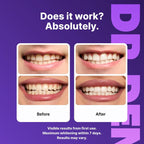 7D Wisdom Tooth Whitening – Gentle, effective dental care with sea salt for bright white teeth