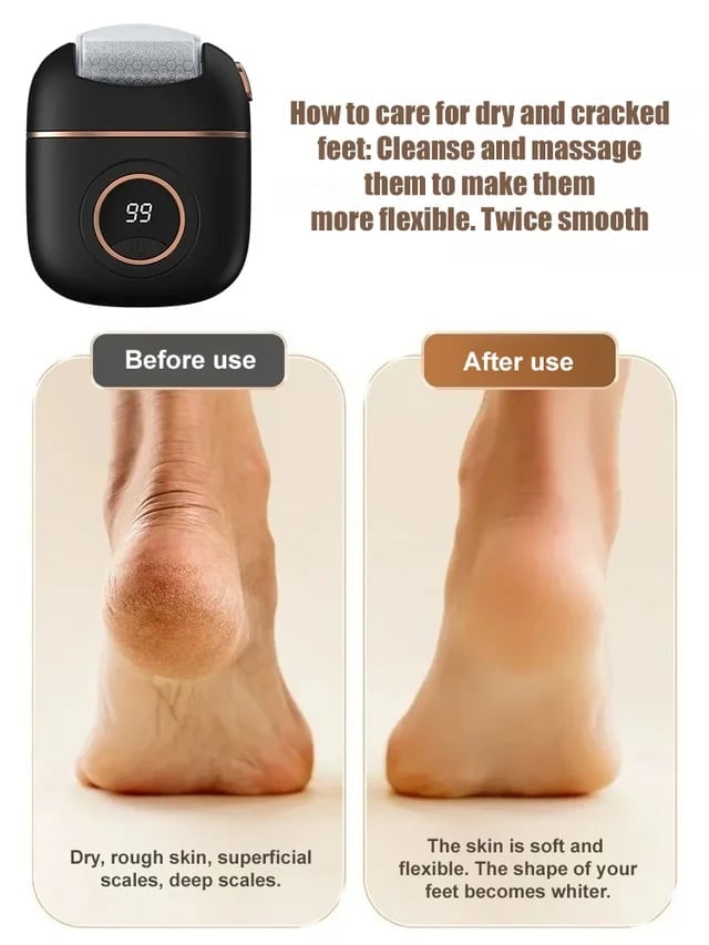New digital electric foot polishing machine