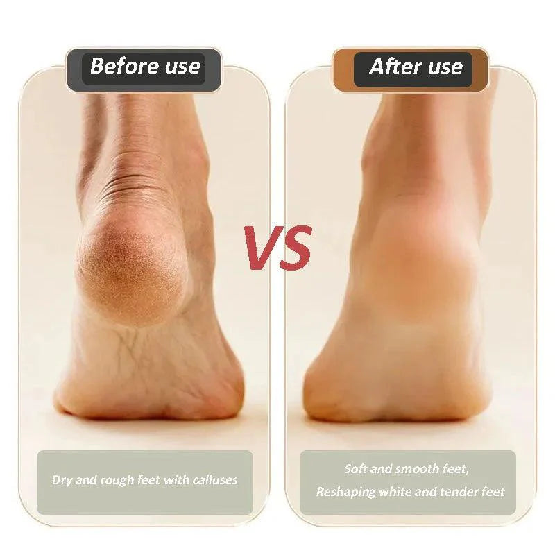 New Digital Electric Foot Polisher