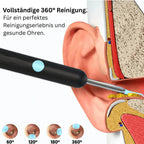 50% discount Intelligent waterproof visual earwax remover