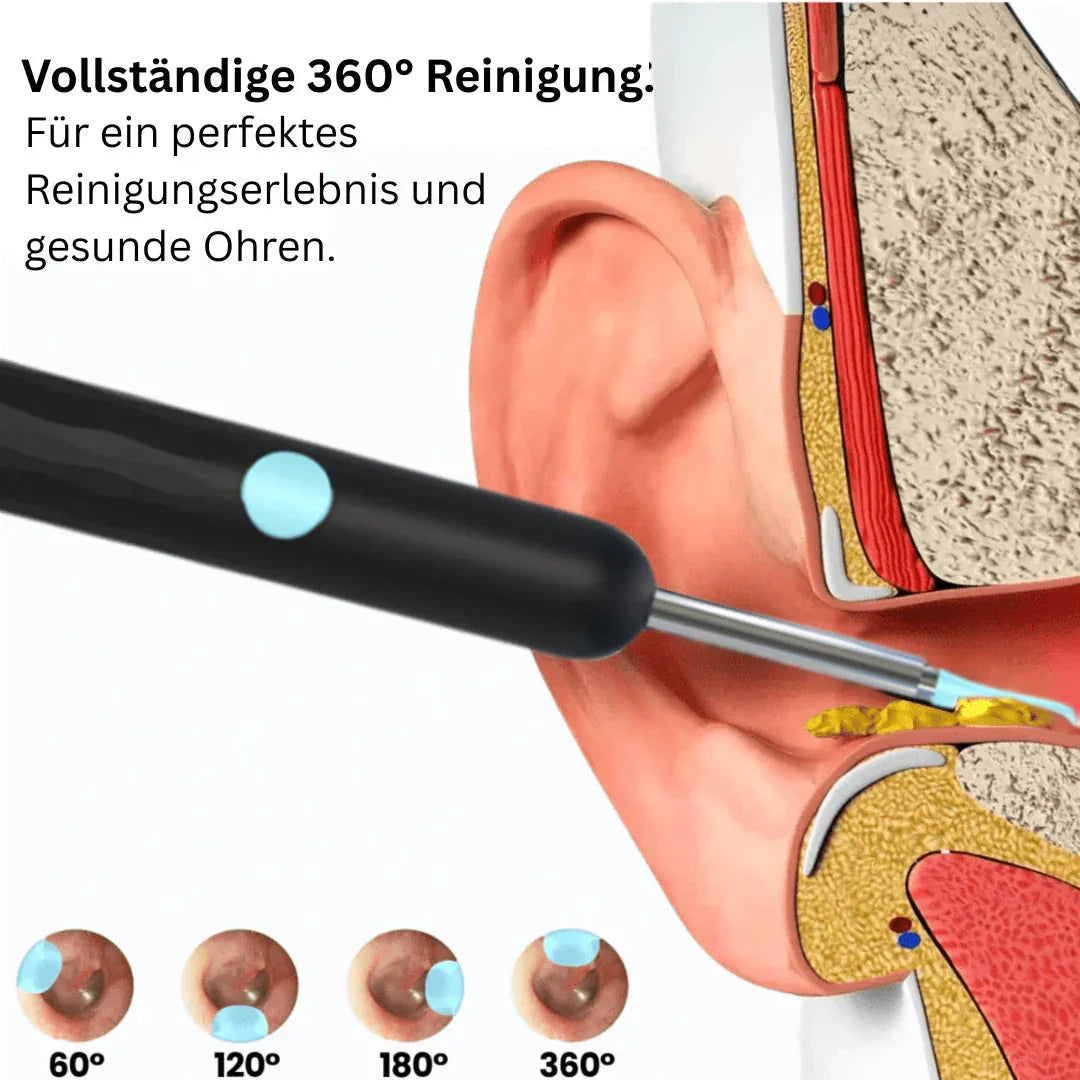 50% discount Intelligent waterproof visual earwax remover