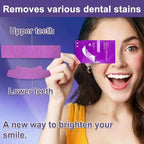 Professional Teeth Whitening at Home Effective and safe strips for a dazzling smile