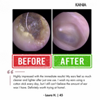 KANIA™ Electric Ear Wax Removal Kit