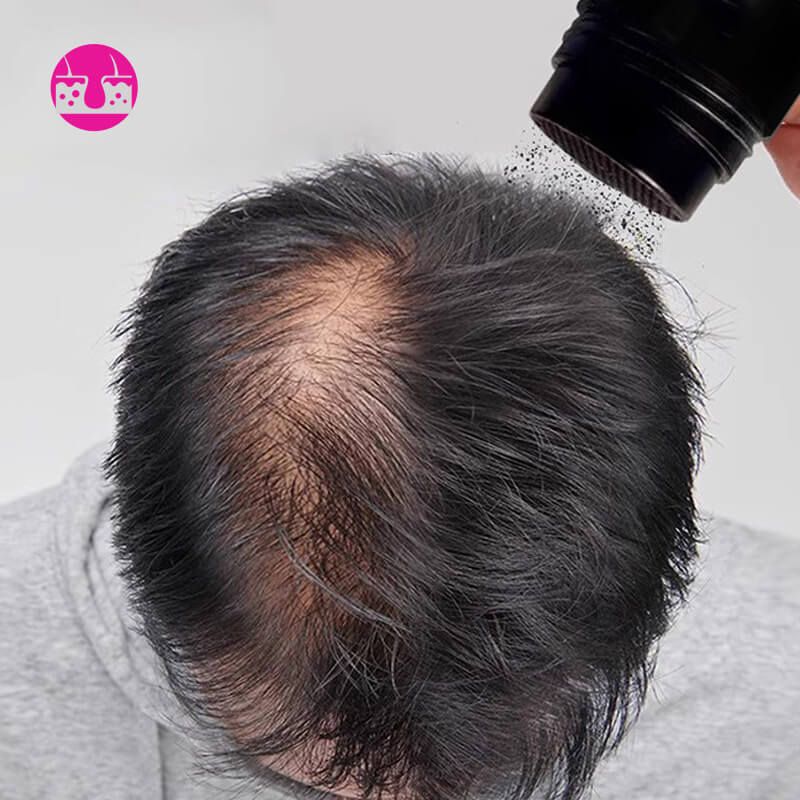Sale Hair Thickening Hair Building Fiber Powder