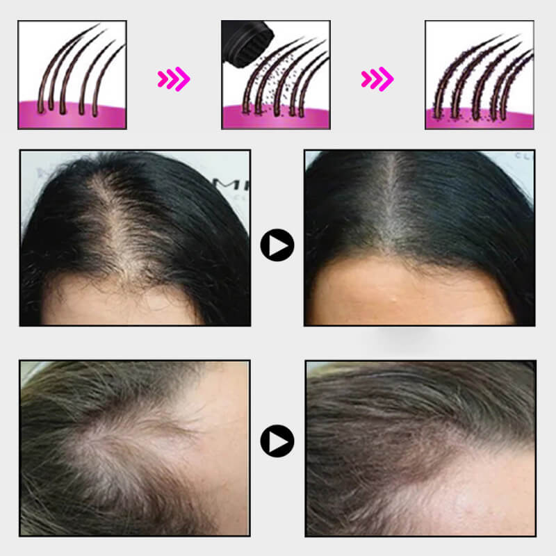 Sale Hair Thickening Hair Building Fiber Powder
