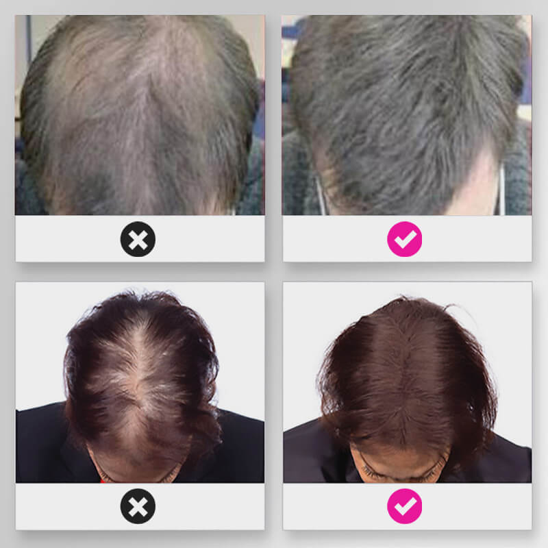Sale Hair Thickening Hair Building Fiber Powder