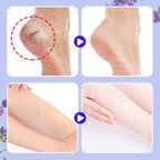 Nourishing and repairing dry and cracked skin Look 20 years younger in an instant Come and give your feet a fresh new look