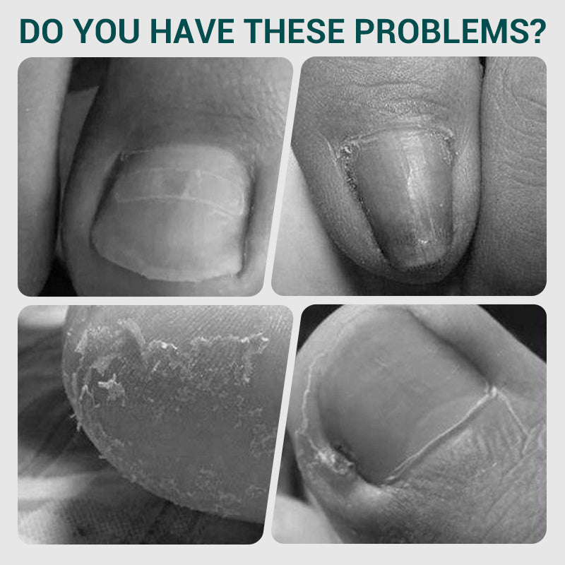 Pro Angled Spring Nail Clipper