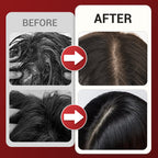 Multi-function Head Massage Comb Deep Relaxation, Scalp Care, One-Touch Comfort Experience