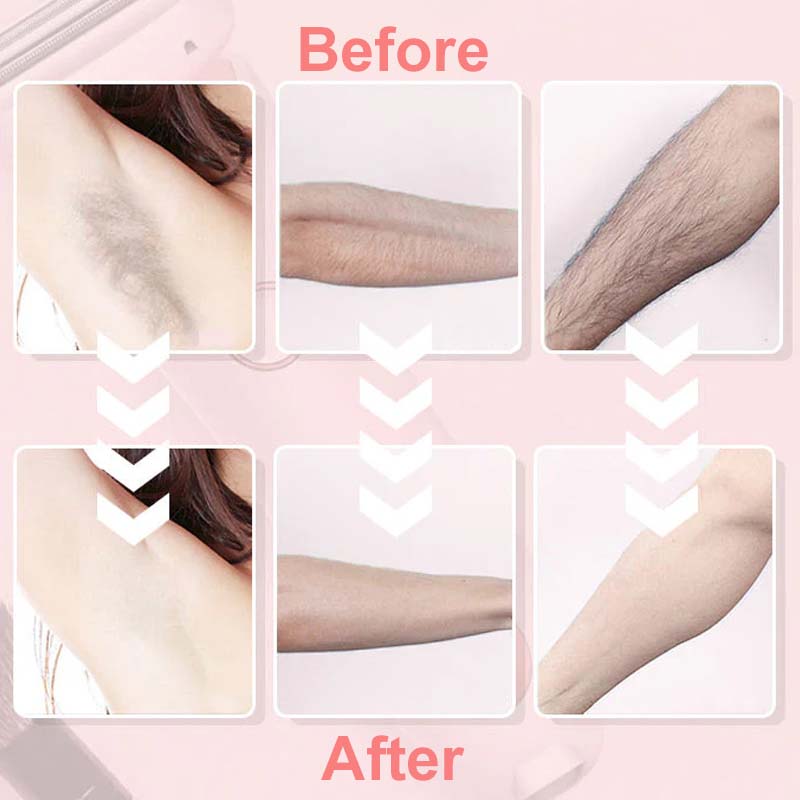 Electric Body Hair Trimmer for Men & Women