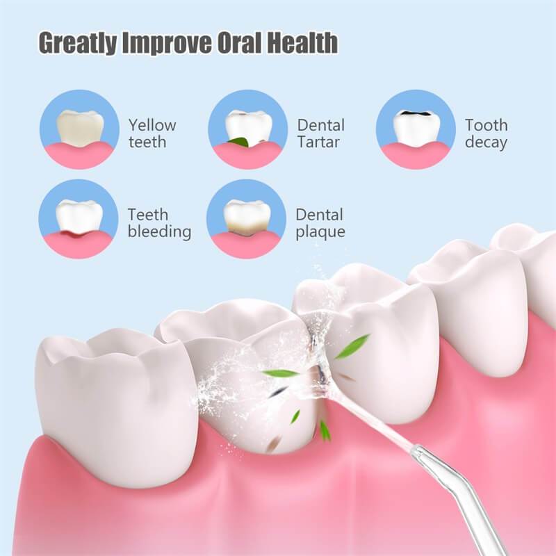 Hurry up！！ for a during the event Portable Oral Irrigator Water Flosser