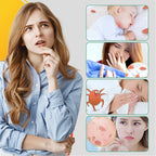 Effective and gentle tick spray for home use