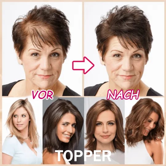 Only $19.99 Breathable Natural Hair Tips for Women with Thinning Hair