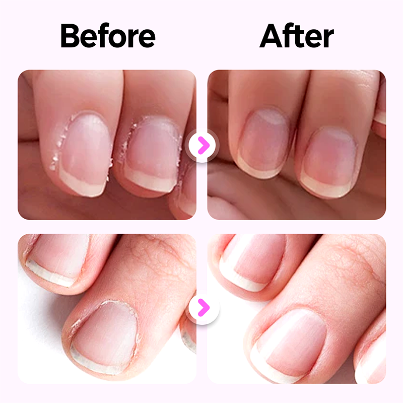 New Upgraded 3-in-1 Nail Care Pen