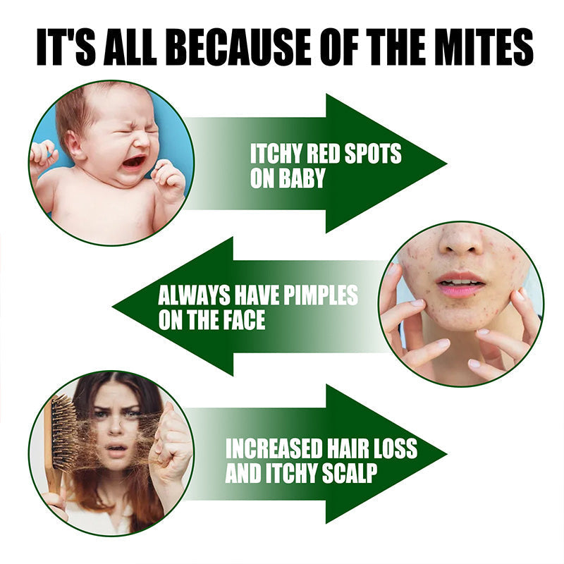 Limited Sale Powerful Mite Remover Spray