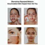 Christmas promotion Radiant Skin & Spot Correcting Spray