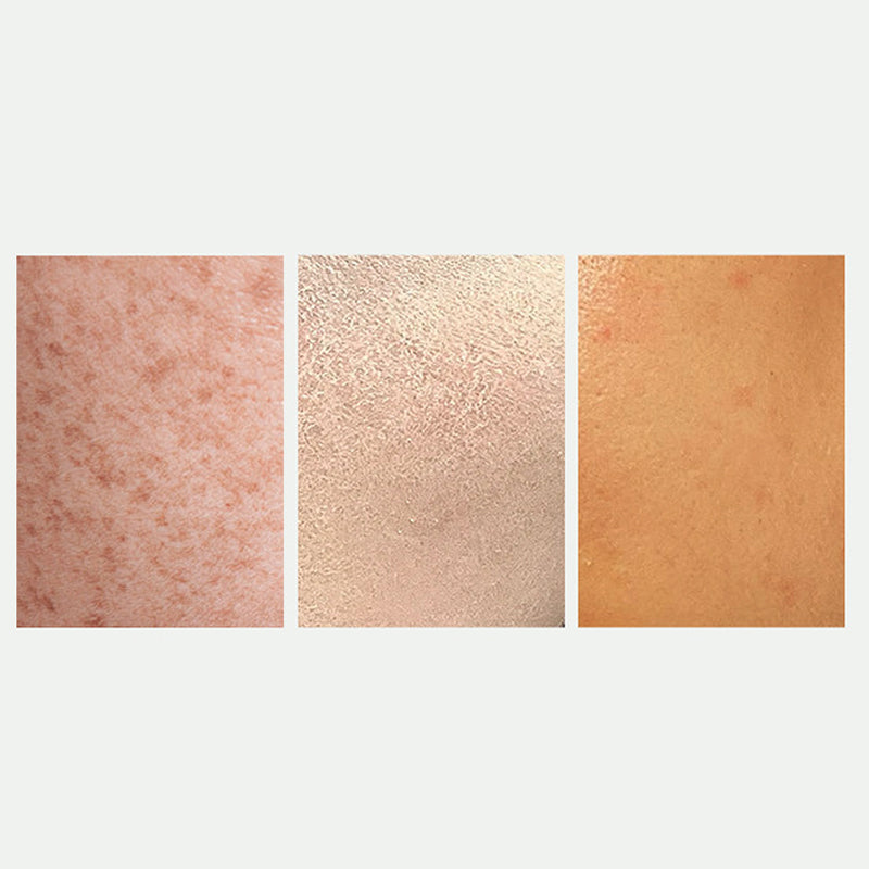 Christmas promotion Radiant Skin & Spot Correcting Spray