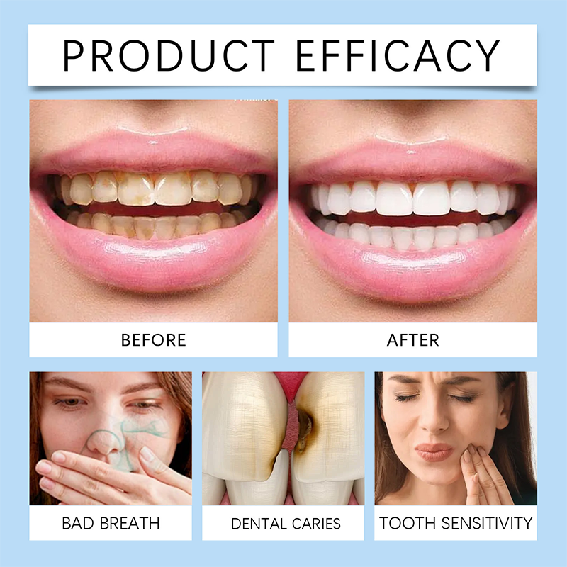 Daily Dental Care Spray – Your On-the-Go Oral Health Shield