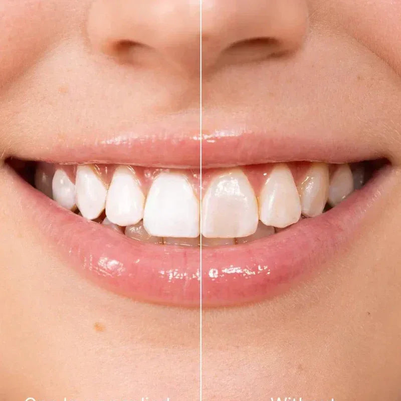 Sale - !! 5ml Instant Whitening Tooth Paint