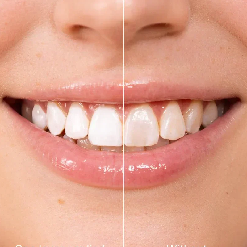 5ml Instant Whitening Tooth Paint